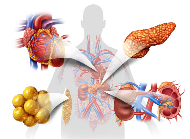 Type 2 Diabetes Management