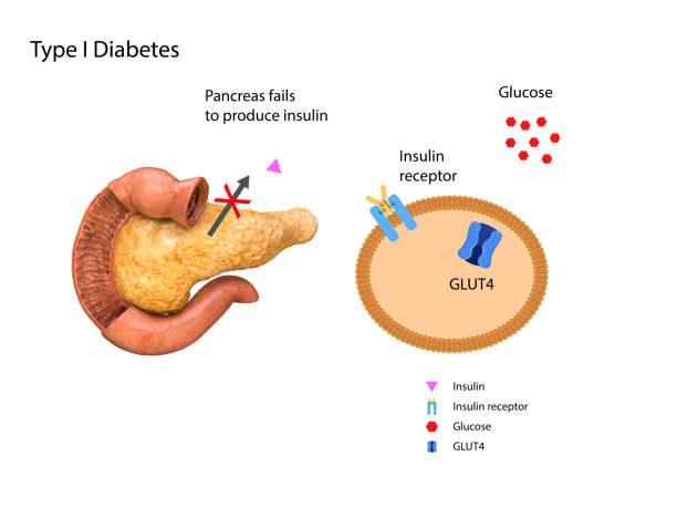 hypoglycemia